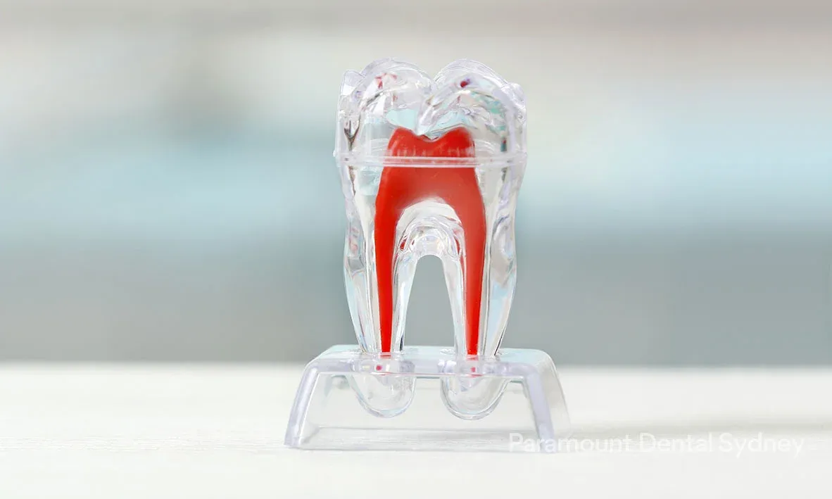 Pulpotomy (Baby Root Canal)